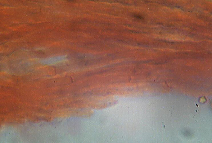 Mycoacia uda